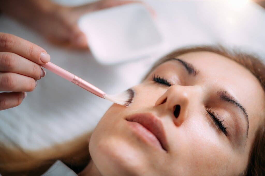 Woman applying chemical peel treatment